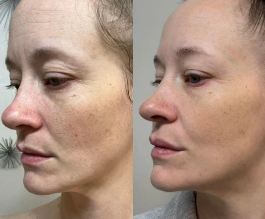 TONIFICADOR FACIAL 3 EN 1 - Tu aliado para una piel con apariencia más firme y definida.
